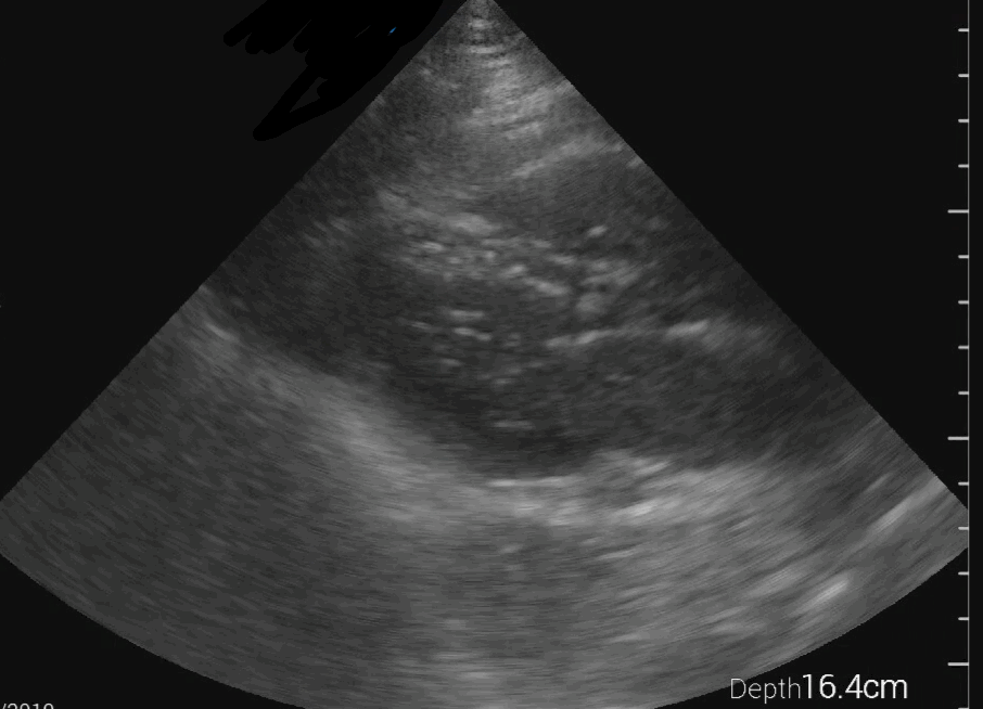 EEU case image missing